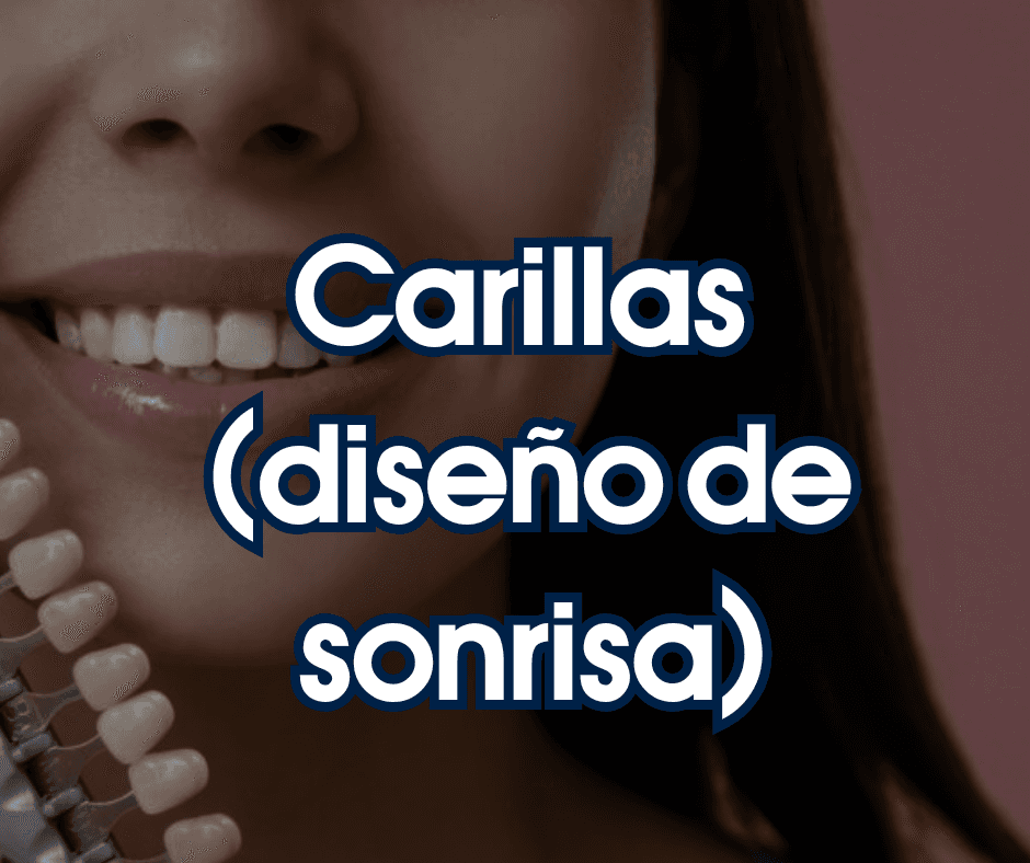 Diseño de sonrisa