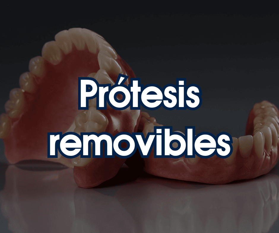 Prótesis removibles