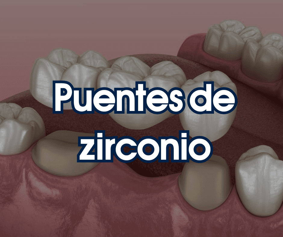 Puentes